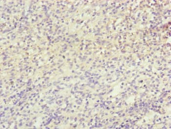 Polyclonal Rabbit anti-Human NDUFB5 Antibody (IHC, IF, WB)