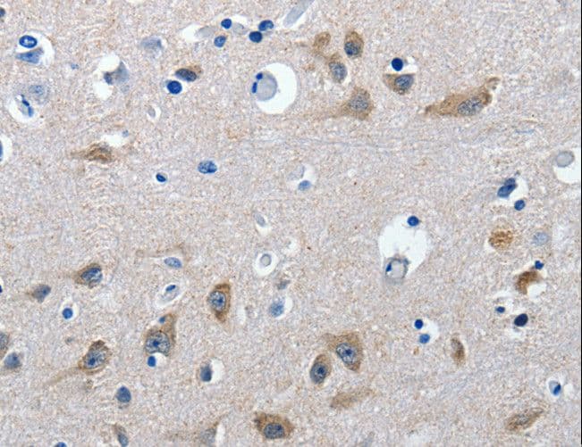 GAD65 Antibody