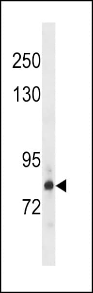 IHC-plus™ HDGFRP2 Antibody (aa51-79)