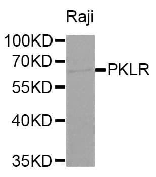 PKLR Antibody