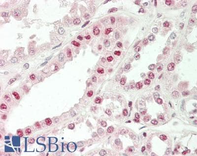 IHC-plus™ DBP5 / SON Antibody (aa1413-1628)