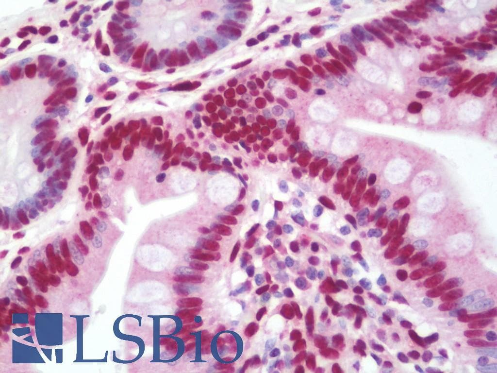 IHC-plus™ HNRNPA3 / HnRNP A3 Antibody (aa30-57)