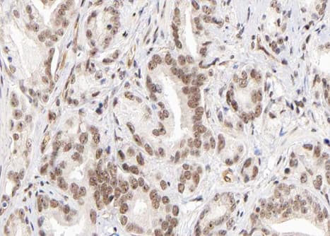 KMT2D / MLL2 Antibody