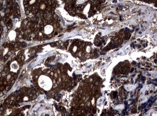 NME1 / NM23 Antibody (clone UMAB93, Carrier-free)