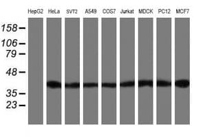 SETD7 / SET7 Antibody (clone OTI2D10)