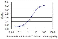 Monoclonal Mouse anti-Human ABCC8 / SUR1 Antibody (clone 3E1, WB)