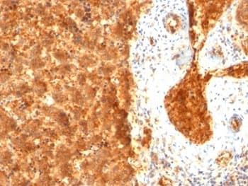 Alpha-Fetoprotein Antibody (clone SPM334, Azide-free, BSA-free)