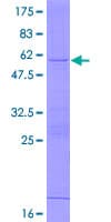Human RPL19 / Ribosomal Protein L19 (Recombinant GST)