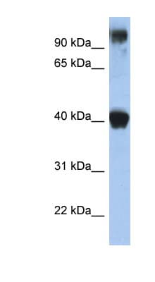 TFAP2E Antibody (N-Terminus)
