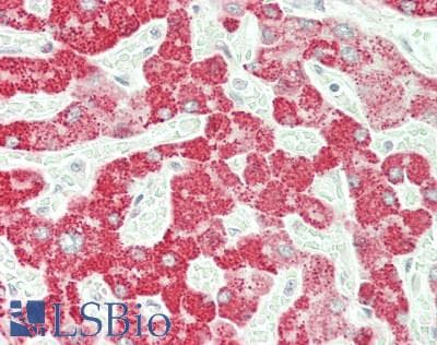 IHC-plus™ Polyclonal Rabbit anti-Human SERPINA4 / Kallistatin Antibody (IHC, IF, WB)