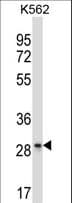 LAIR1 / CD305 Antibody (aa177-206)