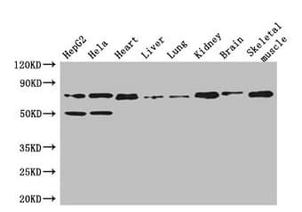 COL8A1 / Collagen VIII Alpha 1 Antibody
