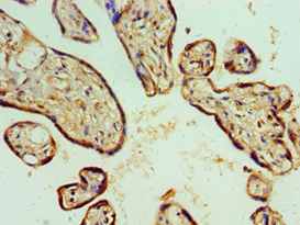 ASCC3 Antibody (aa1-111)
