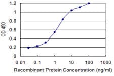 Monoclonal Mouse anti-Human VR1 / TRPV1 Antibody (clone 1A8, WB)