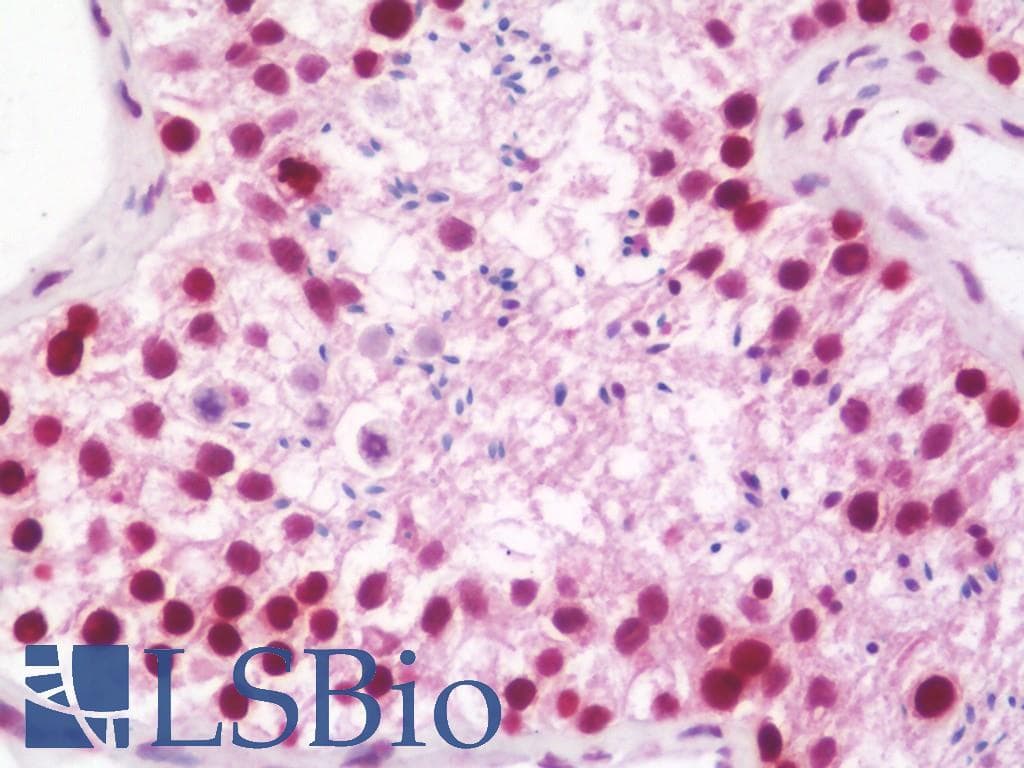IHC-plus™ HDGFRP2 Antibody (aa51-79)