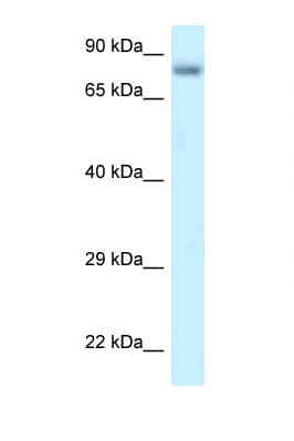 Polyclonal Rabbit anti-Human PPP6R3 / SAPS3 Antibody (aa627-676, WB)