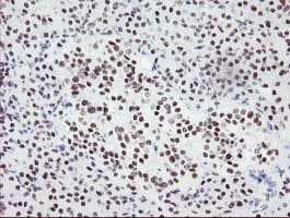 Monoclonal Mouse anti-Human SENP2 Antibody (clone OTI1H2, IHC, IF, WB)
