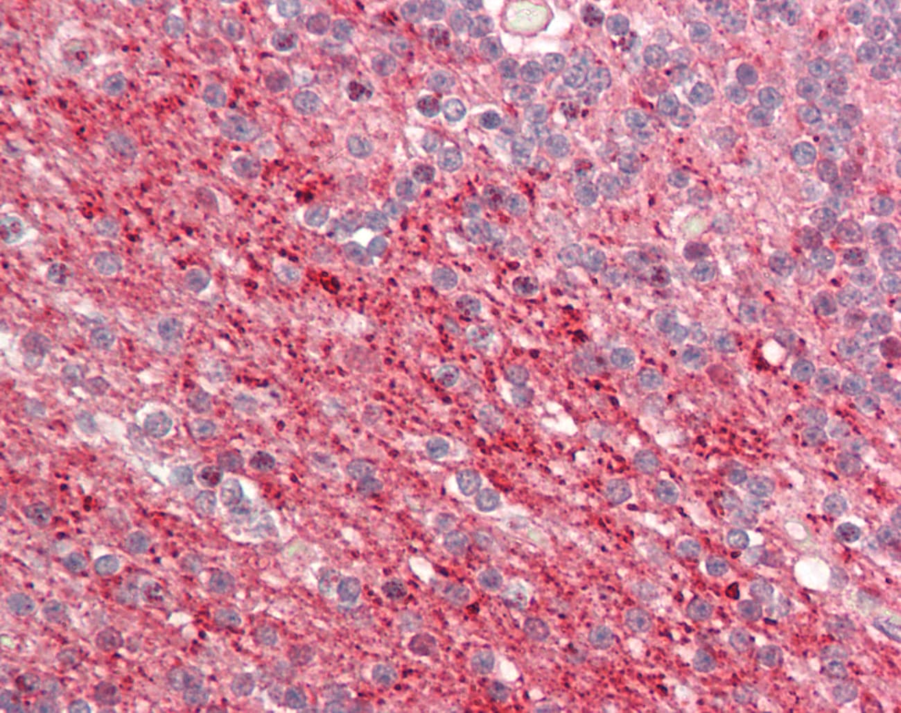 RAIG2 / GPRC5B Antibody (aa61-110)