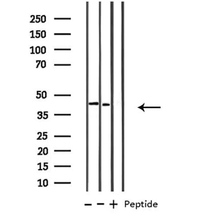 B4GALT1 Antibody