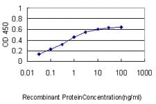 Monoclonal Mouse anti-Human FE65L1 / APBB2 Antibody (clone 2D8, WB)