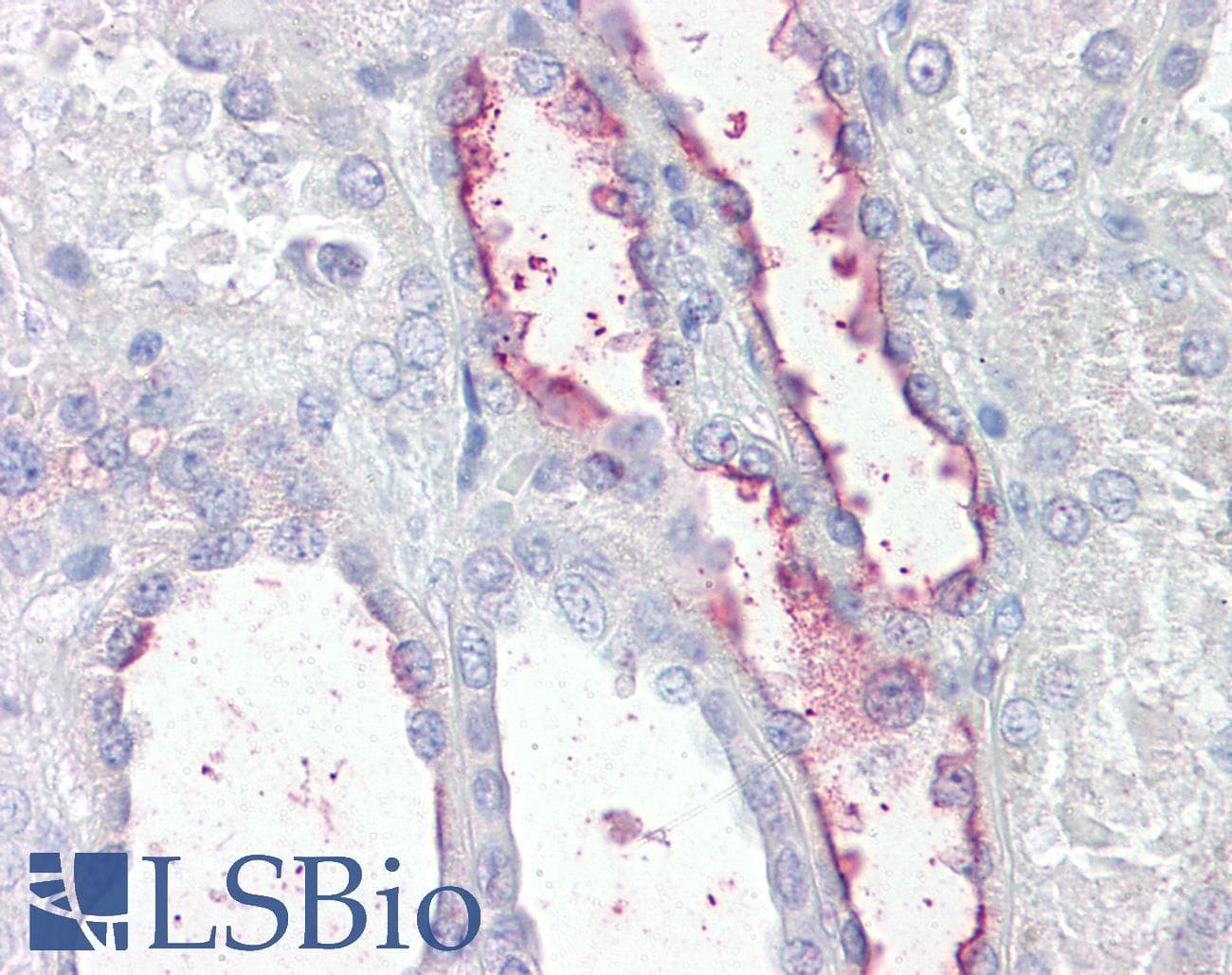 IHC-plus™ KCNE3 Antibody (aa39-51)
