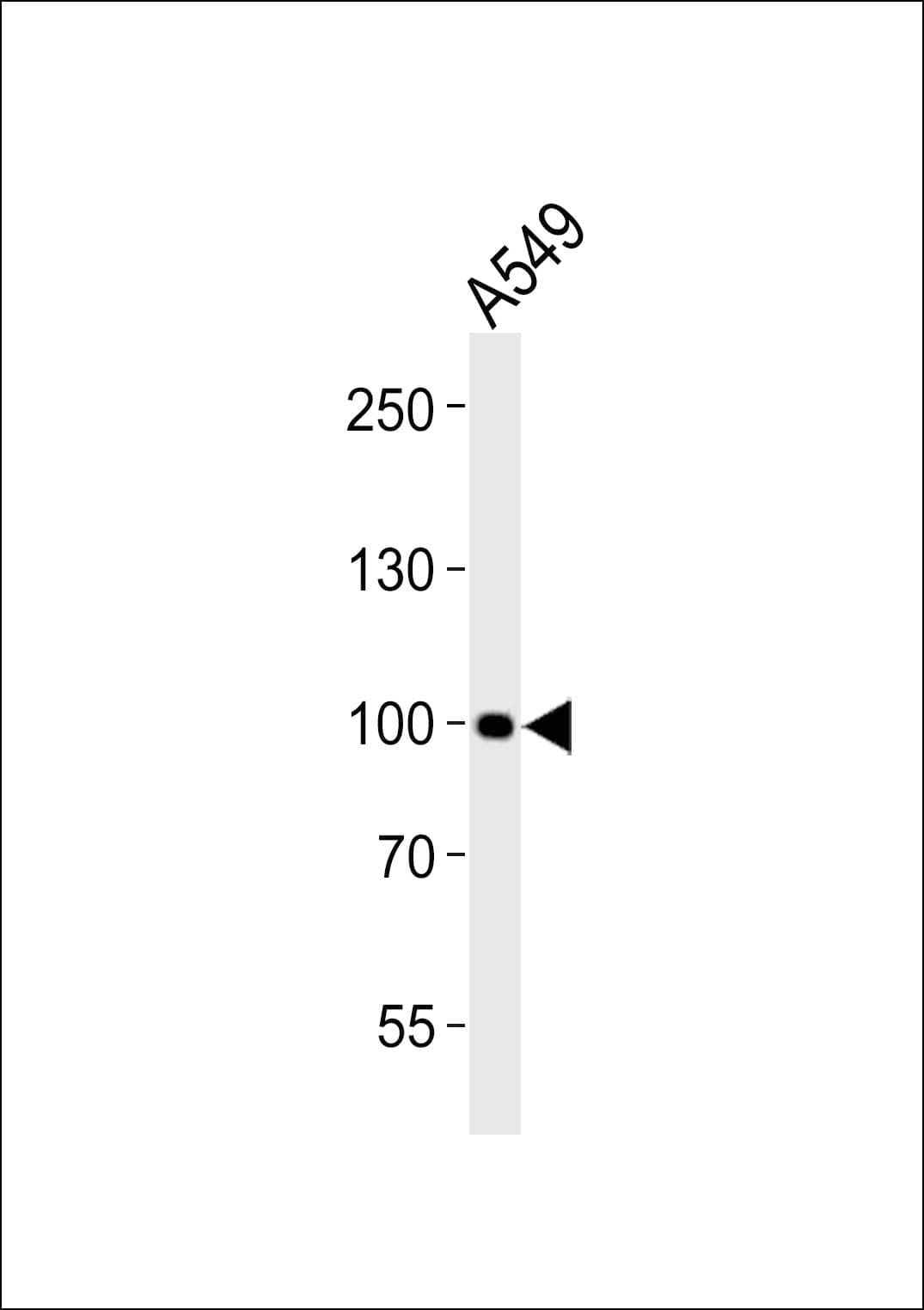 Polyclonal Rabbit anti-Human CHSY3 / CSS3 Antibody (aa295-329, WB)