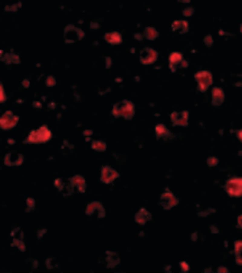 IHC-plus™ SATB1 Antibody