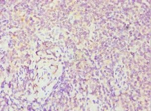 FES Antibody (aa120-420)