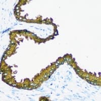 R1 / RRM1 Antibody