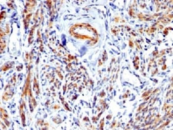 CALD1 / Caldesmon Antibody (Azide-free, BSA-free)