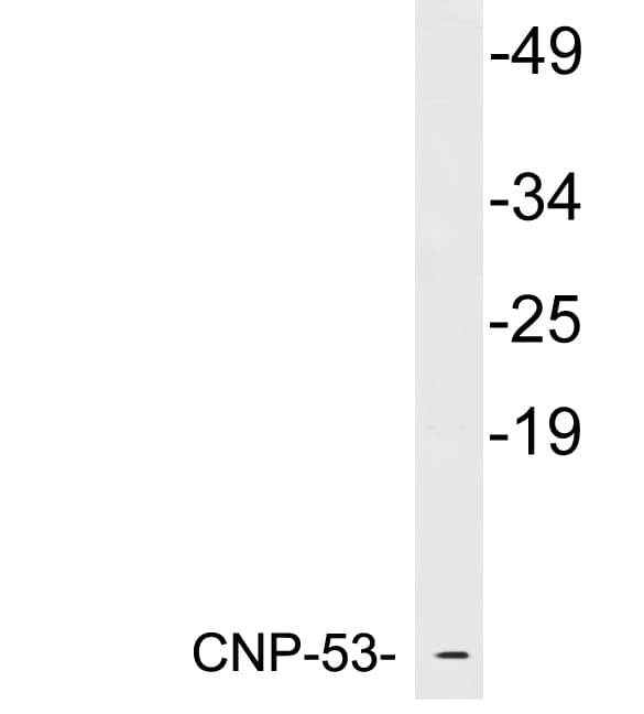 NPPC Antibody (aa26-75)