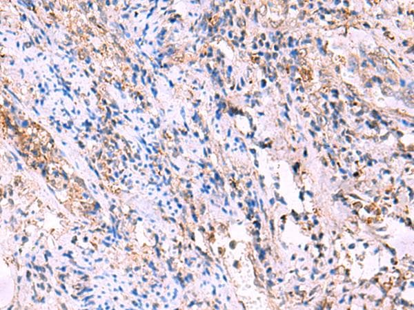 Polyclonal Rabbit anti-Human FUCA2 Antibody (IHC, WB)