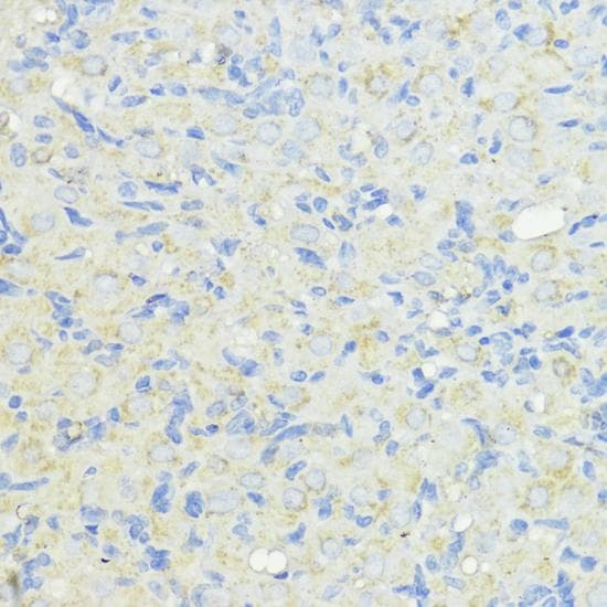 CTSB / Cathepsin B Antibody