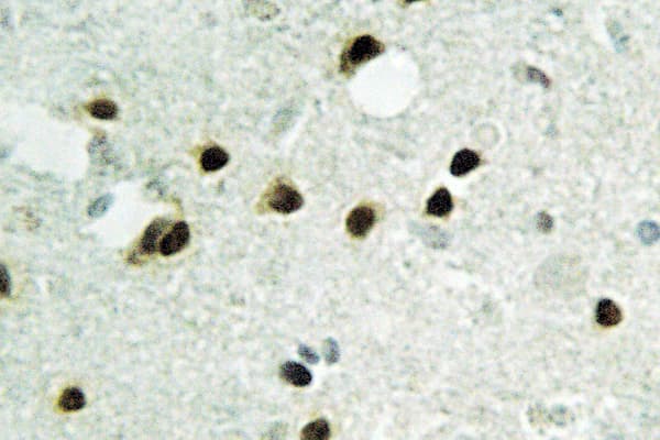 Histone H2B Antibody (Lys24)