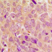 Polyclonal Rabbit anti-Human Ezrin + Radixin + Moesin Antibody (phospho-Thr567/Thr564/Thr558, IHC, IF, WB)