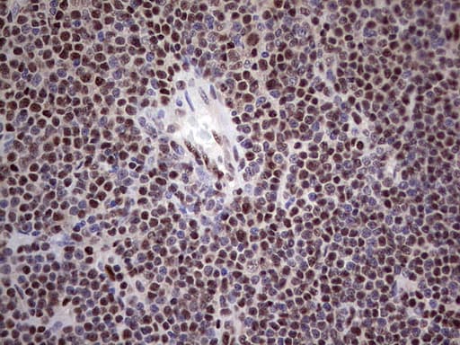 PPP1R8 / Rnase E Antibody (aa1-225, clone OTI4D5)