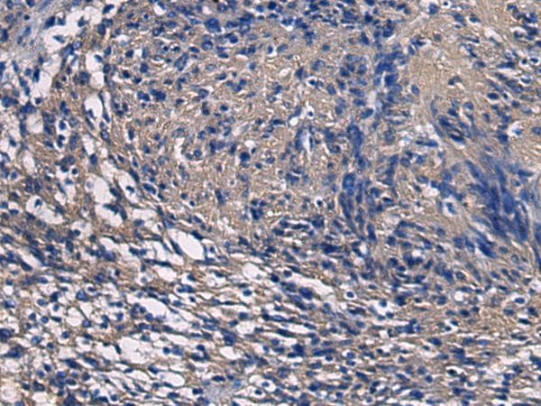 Polyclonal Rabbit anti-Human SSH3 Antibody (IHC)