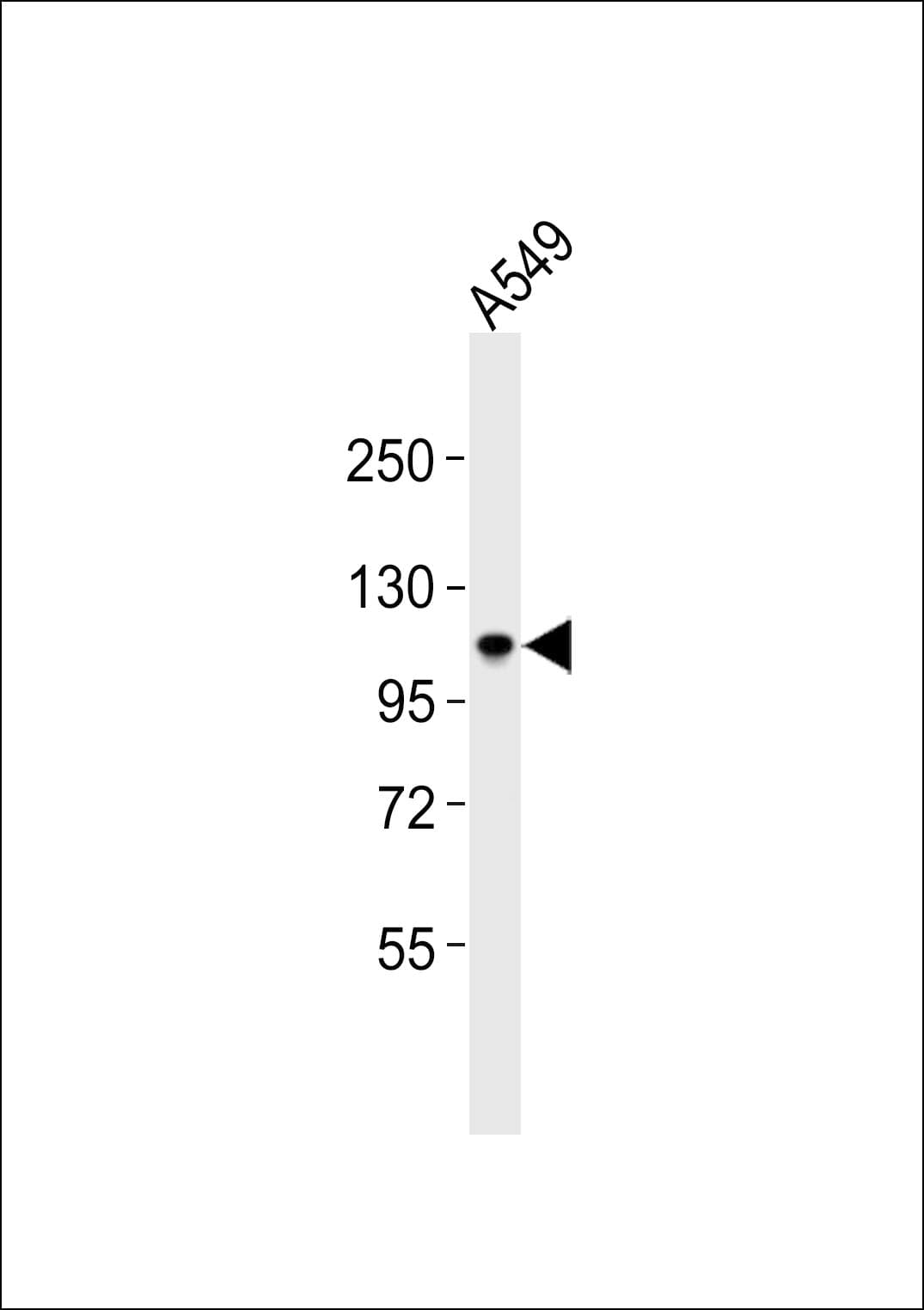 Polyclonal Rabbit anti-Human BRD3 Antibody (WB)