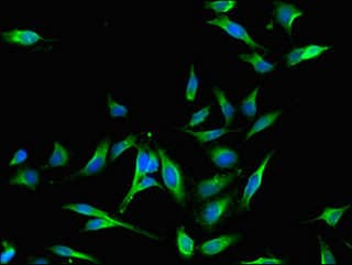 Polyclonal Rabbit anti-Human MAP4 Antibody (IHC, IF)