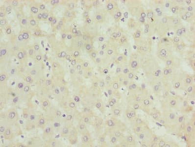 ALAS2 Antibody
