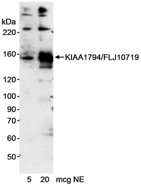 FANCI Antibody (aa200-250)