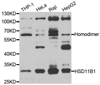 Polyclonal Rabbit anti-Human HSD11B1 / HSD11B Antibody (IHC, WB)
