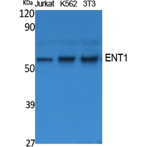 SLC29A1 / ENT1 Antibody (N-terminus, aa15-50)