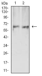 Monoclonal Mouse anti-Human PRKAA2 / AMPK Alpha 2 Antibody (clone 8E11H5, IHC, WB)