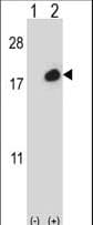 ISG15 Antibody (aa136-165)