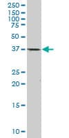 PathPlus™ CDX2 Antibody (clone 1C7)
