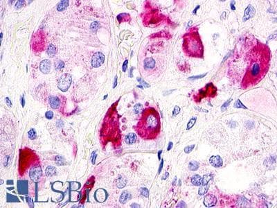 PathPlus™ GPR12 Antibody (Extracellular Domain)