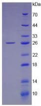 Human LIF Protein (Recombinant His-T7)