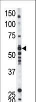 YES1 / c-Yes Antibody (aa1-30)