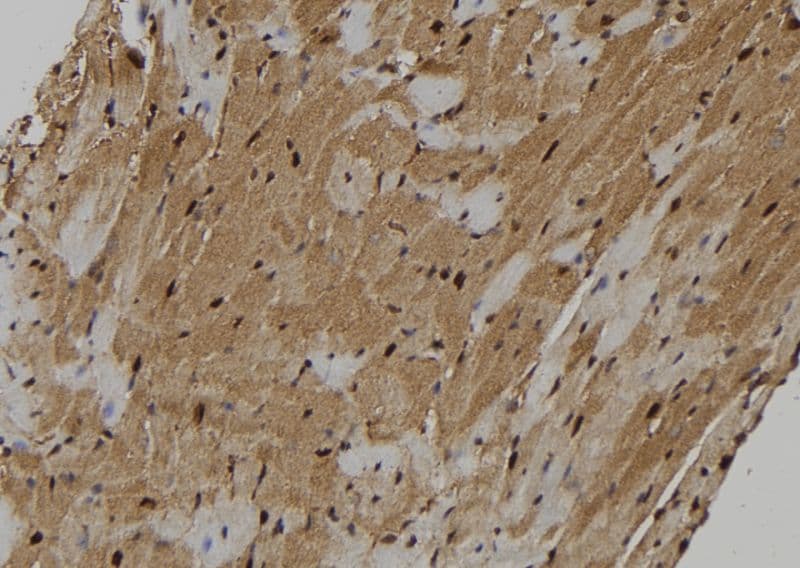 KIF18A Antibody (aa228-252)